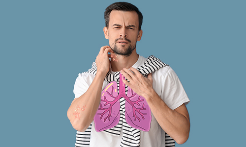 naturopath surrey hills, allergies food sensitivities